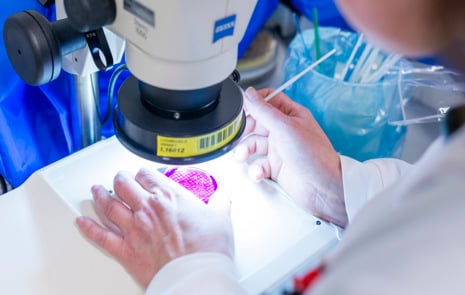 Agar platta som undersöks med ett mikroskop