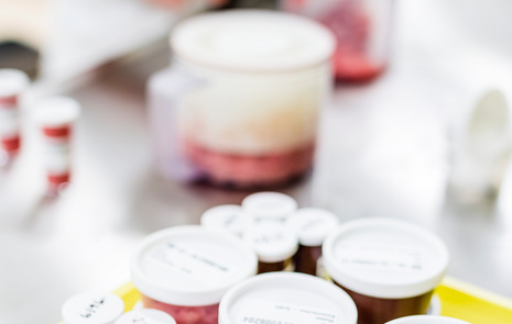 Meat in test tubes and jars in a laboratory